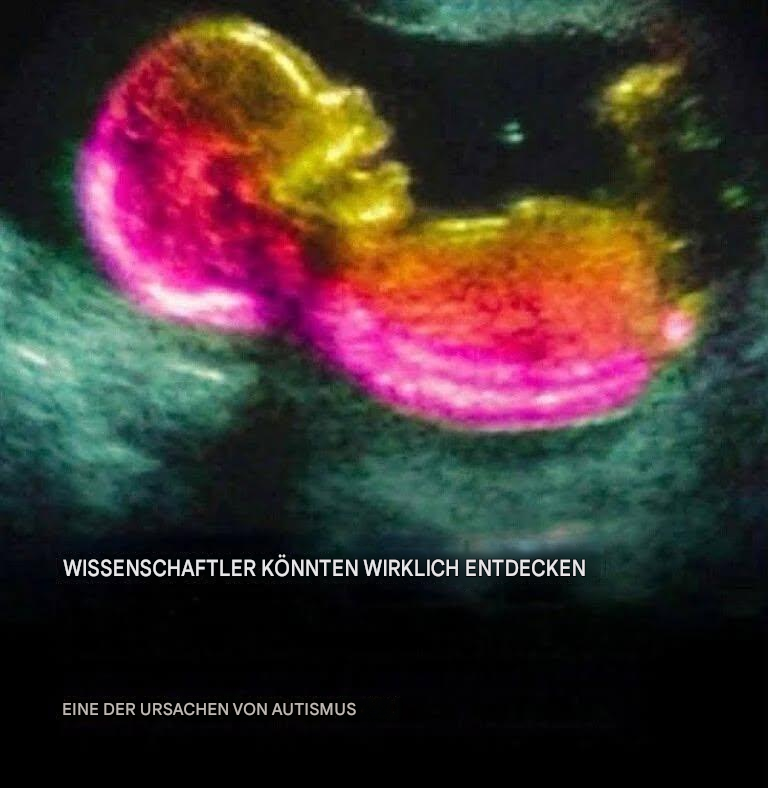 Wissenschaftler haben möglicherweise eine der Ursachen von Autismus identifiziert.