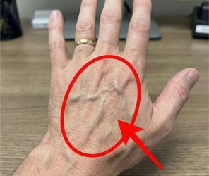 Sichtbare Venen bedeuten, dass Sie… Weiterlesen