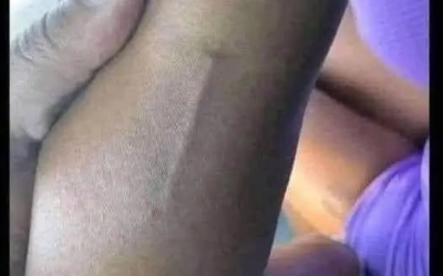 # Ich habe das auf dem Arm meiner Tochter gefunden, ich versuche immer noch herauszufinden, was es ist.