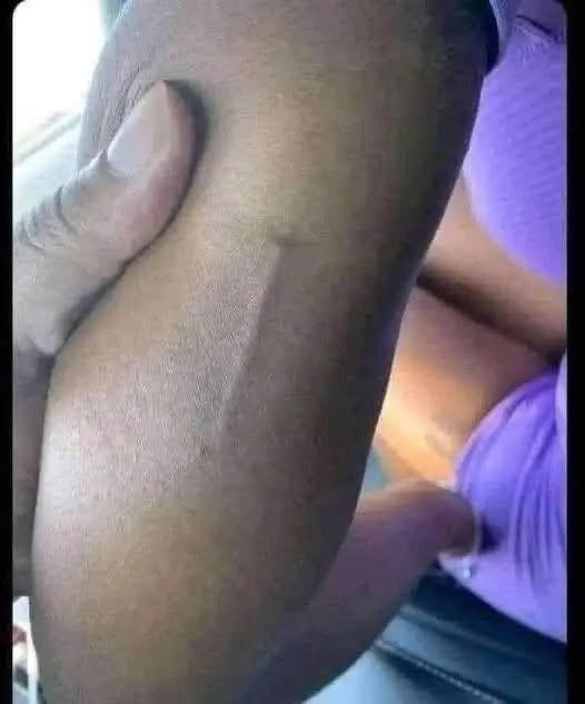 # Ich habe das auf dem Arm meiner Tochter gefunden, ich versuche immer noch herauszufinden, was es ist.