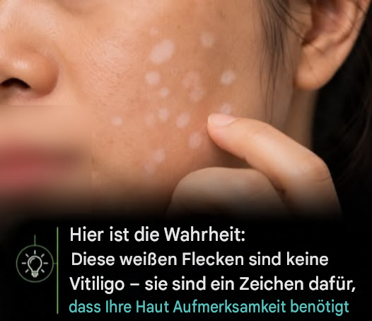 Dies sind die ersten Symptome einer… S