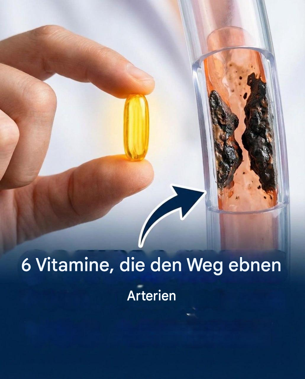 6 Vitamine, die Ihre Arterien befreien!
