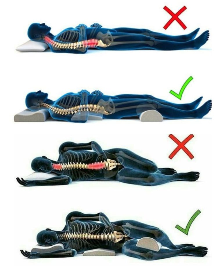Erfahren Sie, warum Ihre Schlafposition entscheidend für Ihre Gesundheit ist.