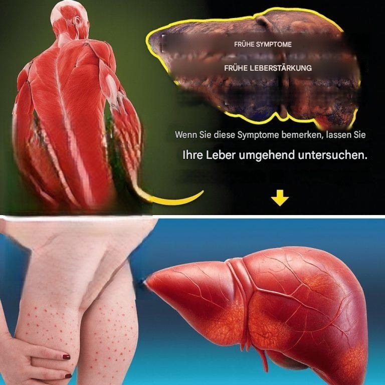 Sie glauben, Sie sind gesund? Ihre Leber sieht das vielleicht anders… Ignorieren Sie diese 12 versteckten Warnzeichen nicht!