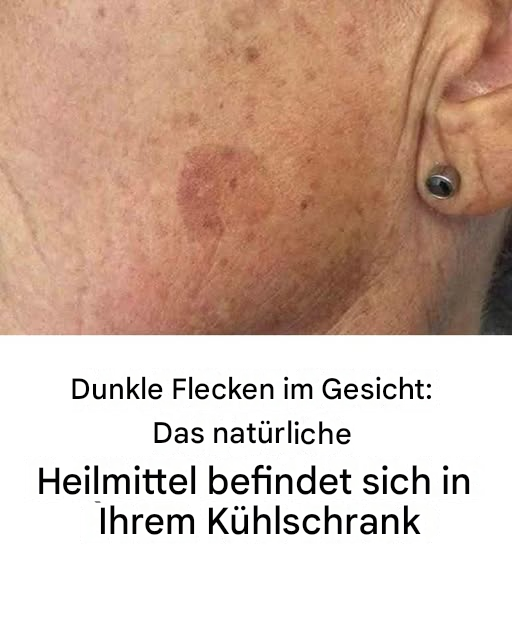 Mischen Sie es in Ihre Creme und Hautunreinheiten im Gesicht gehören der Vergangenheit an.