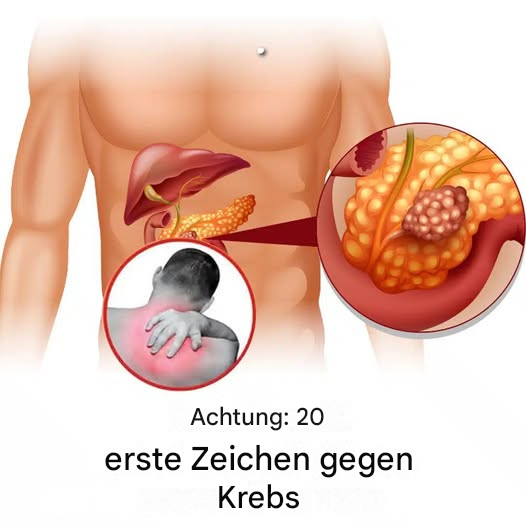 20 Segnali di Allarme beginnen, bis Ihr Körper mit einem Malattien kämpft