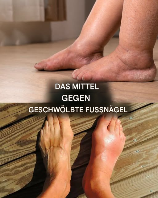 Weichen Sie Ihre Füße ein und geben Sie ein paar Löffel davon hinein: Sie werden sofortige Linderung spüren. Verpassen Sie dieses hervorragende Hausmittel nicht, wenn Sie unter geschwollenen Knöcheln leiden 👇 – Rezepte aus aller Welt
