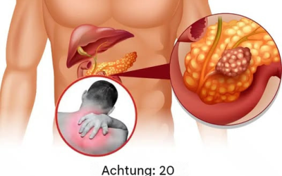 20 Frühwarnzeichen dafür, dass Ihr Körper gegen eine Krankheit ankämpft