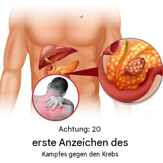 20 Frühwarnzeichen dafür, dass Ihr Körper gegen eine Krankheit ankämpft