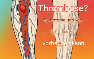 Thrombose: Was ist das, wie erkennt man die Symptome und wie kann man ihr auf natürliche Weise vorbeugen?