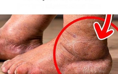 Das beste Vitamin zur Linderung von Schwellungen in Beinen und Knöcheln