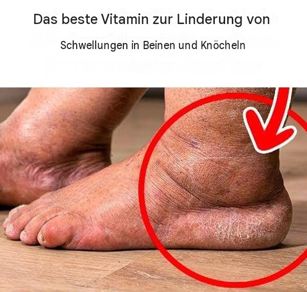 Das beste Vitamin zur Linderung von Schwellungen in Beinen und Knöcheln