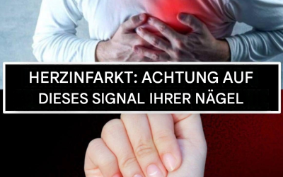 Herzinfarkt – hier ist ein Signal unseres Körpers: Es kommt von unseren Nägeln.