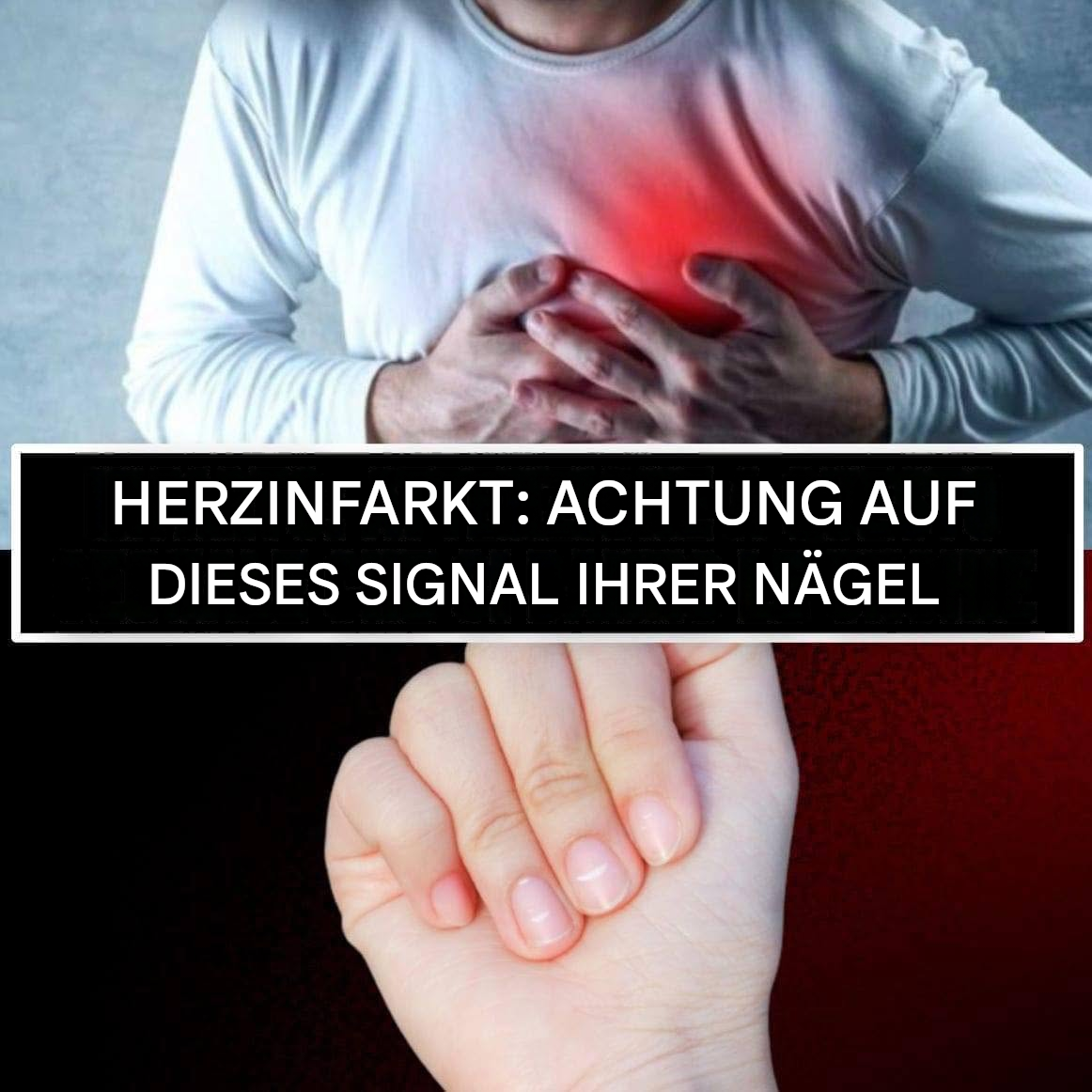 Herzinfarkt – hier ist ein Signal unseres Körpers: Es kommt von unseren Nägeln.