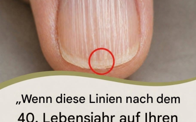 Warum bilden sich nach dem 40. Lebensjahr vertikale Rillen auf den Fingernägeln? Hier ist die Wahrheit.