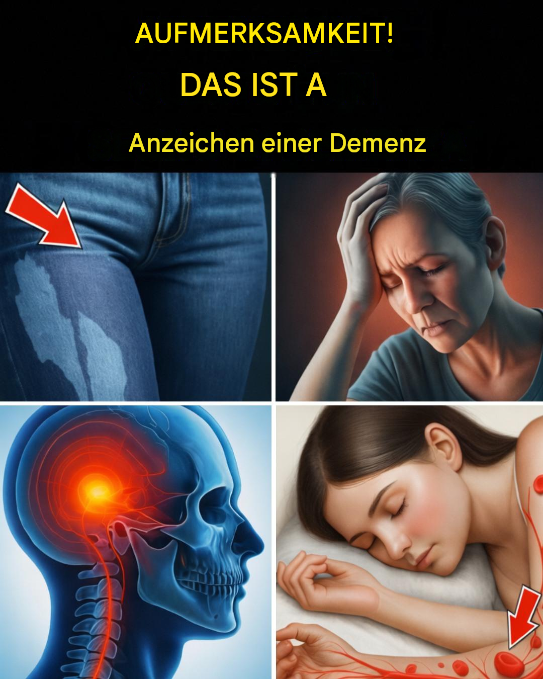Entdecken Sie 9 frühe Anzeichen von Demenz, die nur wenige Menschen bemerken, und 13 klassische Symptome, auf die Sie achten sollten.