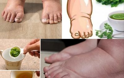 Trinken Sie diesen Tee und Sie werden nie wieder geschwollene Beine, Knöchel oder Füße haben!