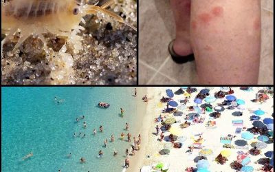 Seeflöhe an italienischen Stränden: Was tun?