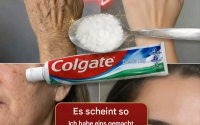 Diese selbstgemachte Behandlung revitalisiert die Haut an Händen und Armen und lässt Unreinheiten verblassen. Um weiterhin meine Rezepte zu erhalten, sag einfach „Danke“!