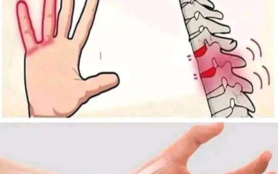Wenn deine Hände einschlafen, ist das ein klares Zeichen dafür, dass du Probleme hast… siehe mehr