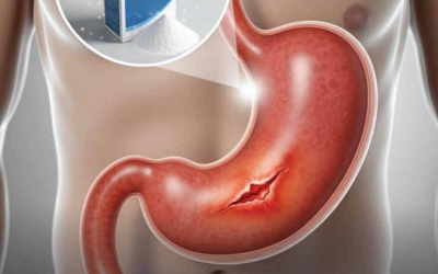 10 überraschende Wege, wie eine Prise Backpulver Ihr Leben verändern kann