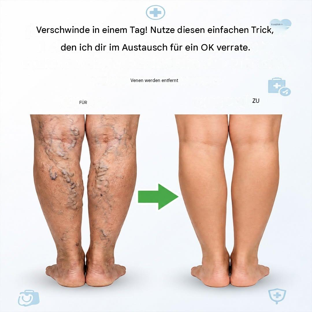 Verabschieden Sie sich von Krampfadern mit dieser bewährten natürlichen Mischung