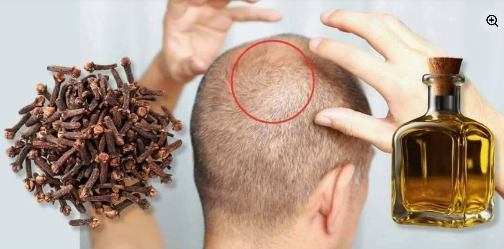 Mit 75 Jahren wachsen die Haare sogar an kahlen Stellen wieder nach! So kann Nelkenöl das Haarwachstum anregen.