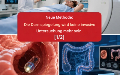 Neue Methode: Die Darmspiegelung wird keine invasive Untersuchung mehr sein. (1/2)