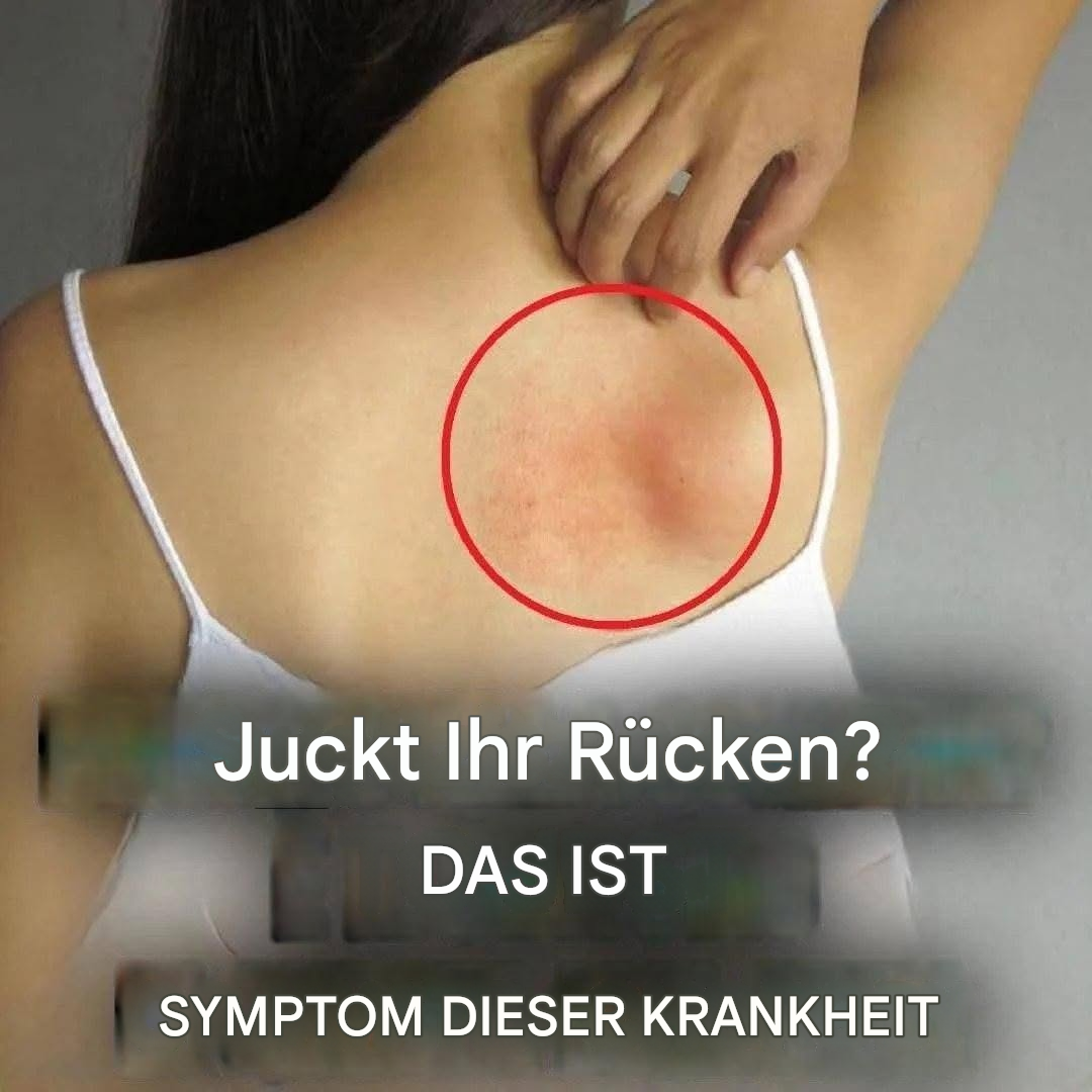 Juckreiz am ganzen Körper: Ursachen und natürliche Behandlungsmethoden (1/4)