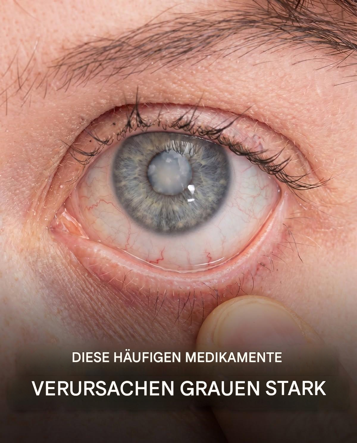 Grauer Star: Was Ihr Arzt Ihnen verschweigt