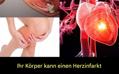 Diese 5 Symptome könnten frühe Anzeichen eines bevorstehenden Herzinfarkts sein.