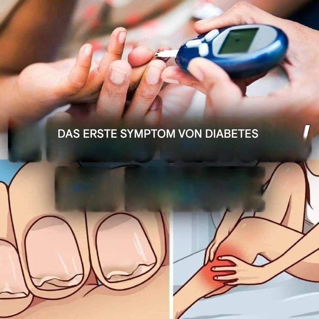 Hier sind die überraschendsten Symptome von Diabetes (1/3).