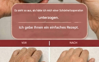 Selbstgemachte feuchtigkeitsspendende Hand- und Nagelmaske zur Verbesserung des Aussehens