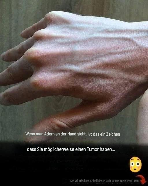 Sichtbare Venen: Häufige Ursachen, Gesundheitsrisiken und wann man sich Sorgen machen sollte.