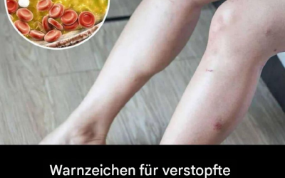 Wie Ihre Füße auf Herzprobleme und verstopfte Arterien hinweisen könnten
