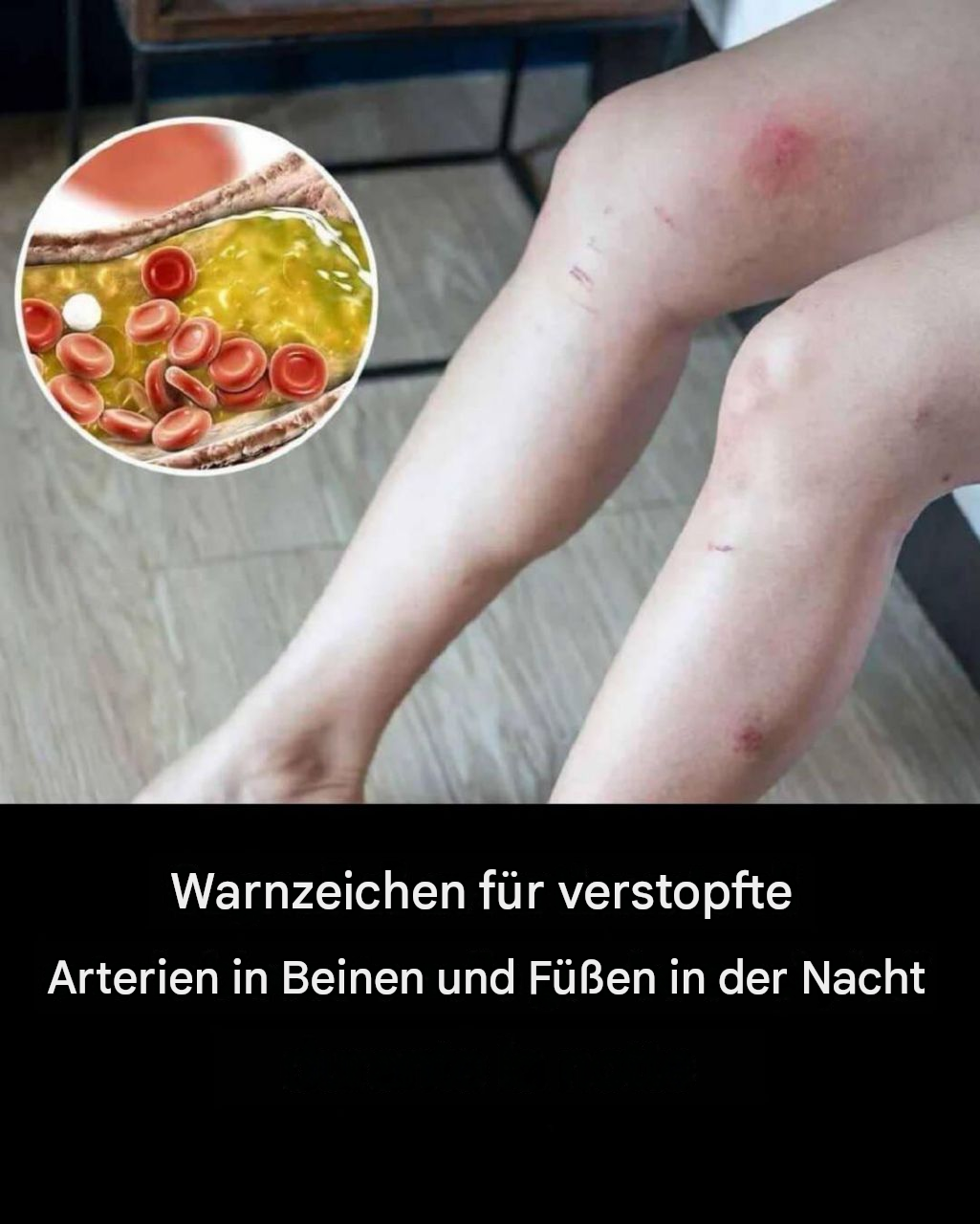 Wie Ihre Füße auf Herzprobleme und verstopfte Arterien hinweisen könnten