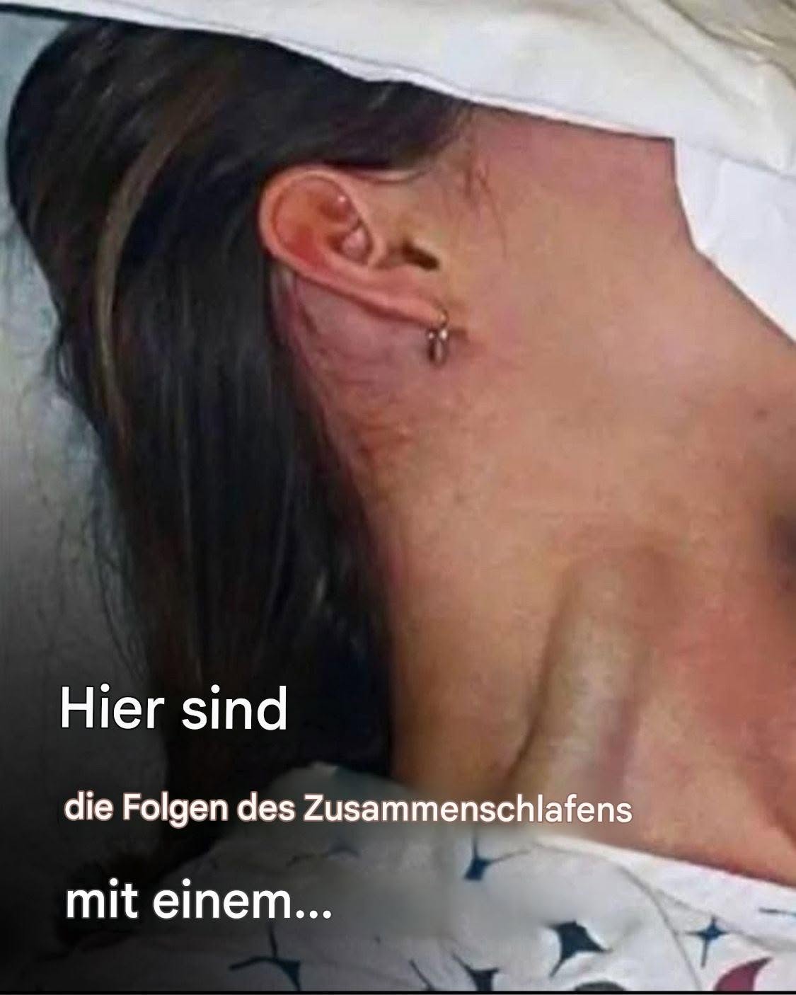 Das sind die Folgen des Zusammenschlafens mit… Mehr anzeigen
