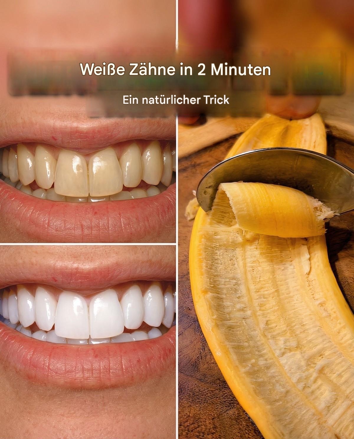 Geheime Zahnärzte, denen Sie lieber nicht begegnen möchten: Entfernt Zahnstein und hellt Ihre Zähne in nur 2 Minuten auf.