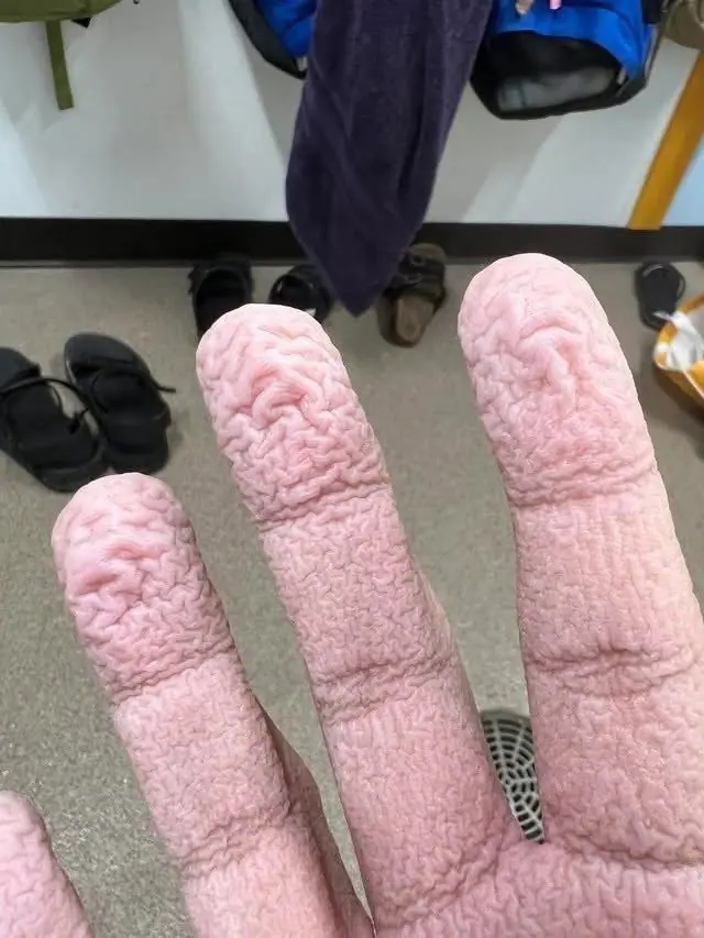 Faltige Finger nach dem Wasser: Was Ihr Körper Ihnen wirklich sagen möchte