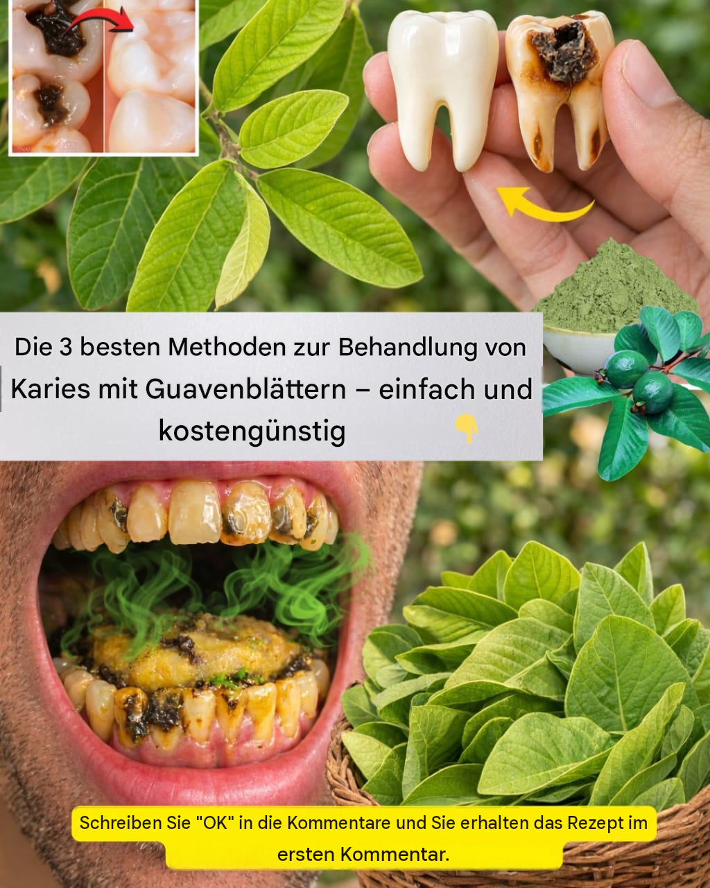 Die 3 besten Methoden zur Behandlung von Karies mit Guavenblättern – einfach und kostengünstig!