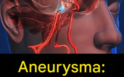 Aneurysma: 12 Warnzeichen, die Sie auf keinen Fall ignorieren sollten