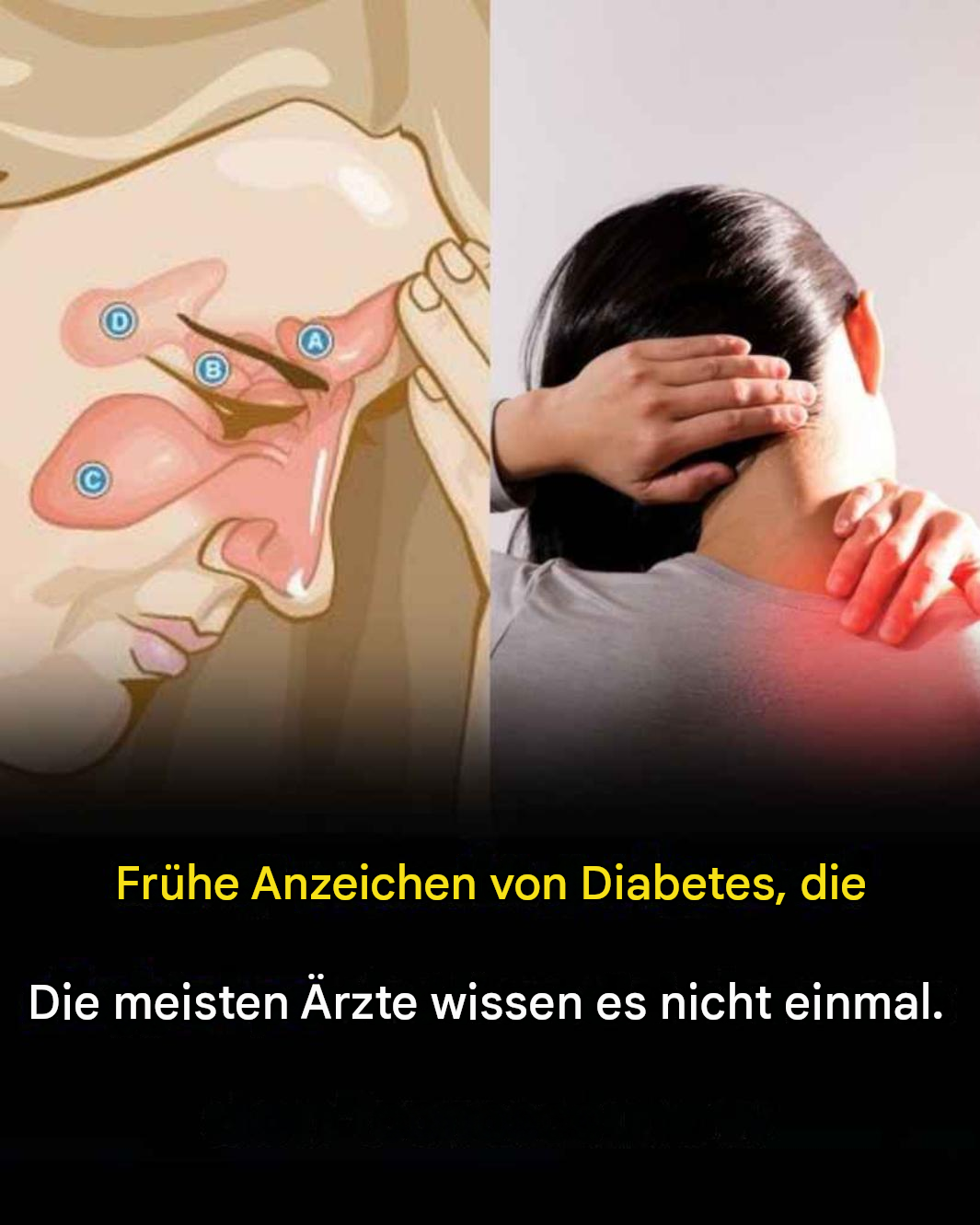 9 frühe und heimtückische Anzeichen von Diabetes, die Sie möglicherweise übersehen.